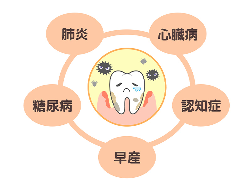 歯周病と全身疾患との関わり - 香川県さぬき市の歯医者｜やまだ歯科